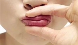 吃哈密瓜嘴唇痒,嘴唇痒痒的奇妙体验