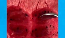 护士可以吃瓜,瓜果分享传递关爱